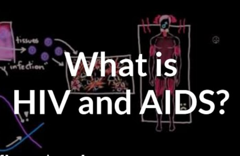 HIV and AIDS Treatment: A Comprehensive Guide